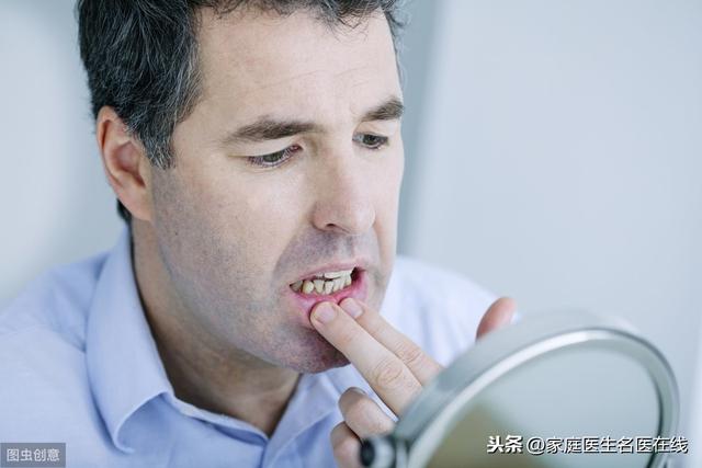 口腔粘膜病常见有4类，其中一种，几乎每人都得过！别说你不知道