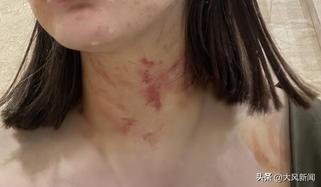 电梯内狗尾巴扫到对方腿,23岁女子遭一对夫妇推搡扯衣胸部裸露?涉事业主夫妇否认,自贡警方已展开调查