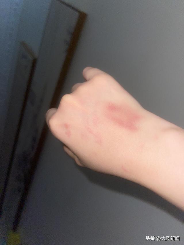电梯内狗尾巴扫到对方腿,23岁女子遭一对夫妇推搡扯衣胸部裸露?涉事业主夫妇否认,自贡警方已展开调查