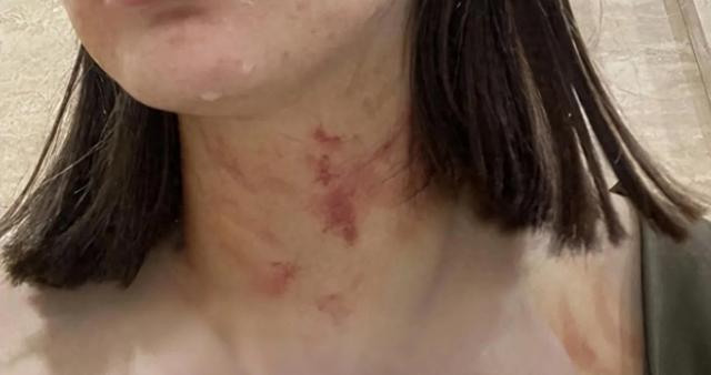 闹大了!漂亮女子被扒衣露胸后续:被判为互殴,吞药自杀遗书曝光